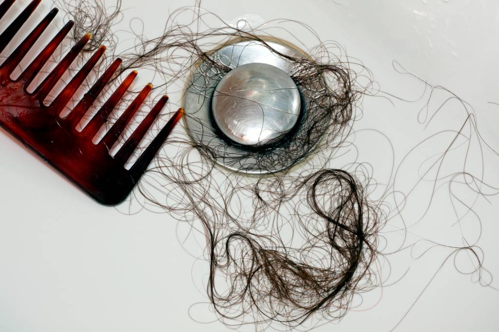 A person suffering from hair loss