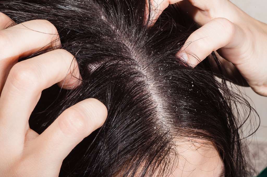 Discover more than 131 aswini hair oil