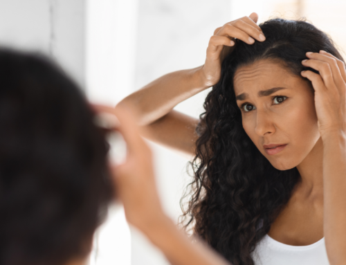 Flaking it Off: The Role of Ayurvedic Oil in Battling Dandruff